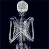 Рентген скелета вращающегося на веревке