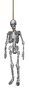 Скелет повесившегося человека