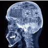 Рентгеновский снимок черепа и надпись на черном фоне (ава...